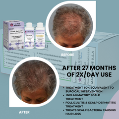 FDA Registered Minoxidil Hair Loss Product Manufacturer Approved Biopharmaceutical Plant