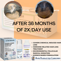 FDA Registered Minoxidil Hair Loss Product Manufacturer Approved Biopharmaceutical Plant