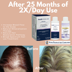 FDA Registered Minoxidil Hair Loss Product Manufacturer Approved Biopharmaceutical Plant