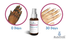 Wholesale 30ml Labeled Solution of Hands & Feet Treatment 500 Units